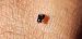 Geocoris erythrocephalus  - Michele Cento